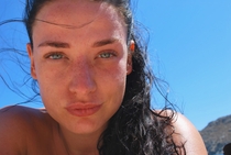 Roaccutane