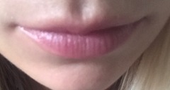 So I have booked in to have lip filler :terrified: