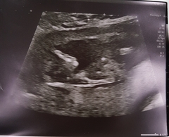 Gender Guesses?