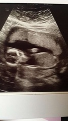 12 week scan?? Any ideas