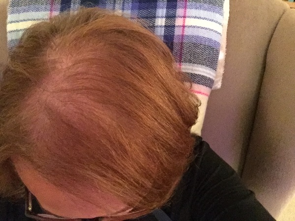 Head shave to go grey