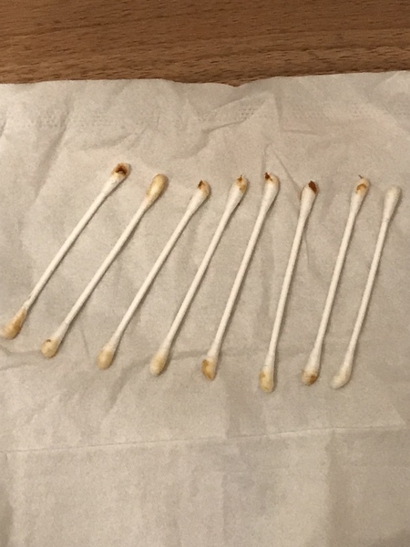 ****Klaxon**** DH's Earwax.  With Pics!