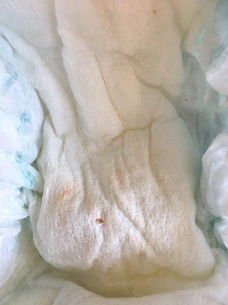 Orange bits in toddlers nappy