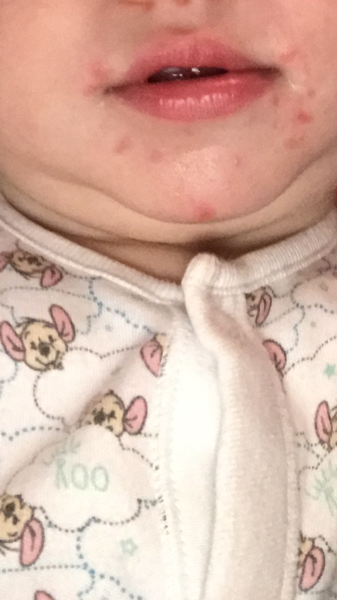 What could this be? (5 yr olds face)