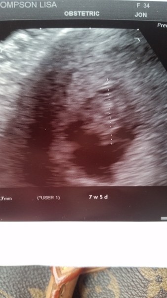 Scan for heartbeat
