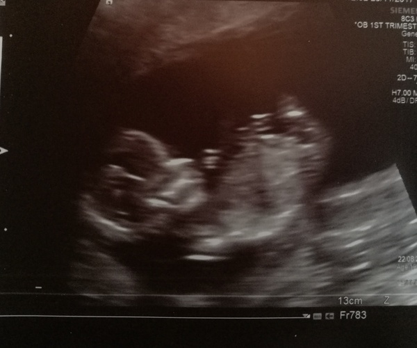 Boy or girl? Not a posing baby!