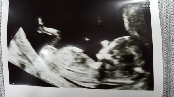 Gender guesses - nub theory