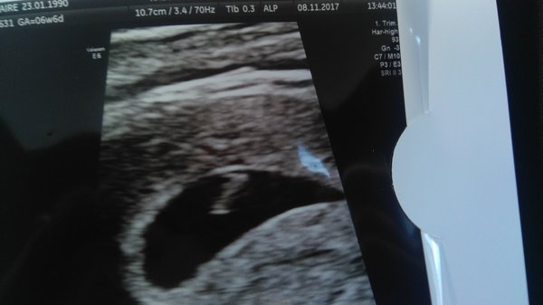 Scan today