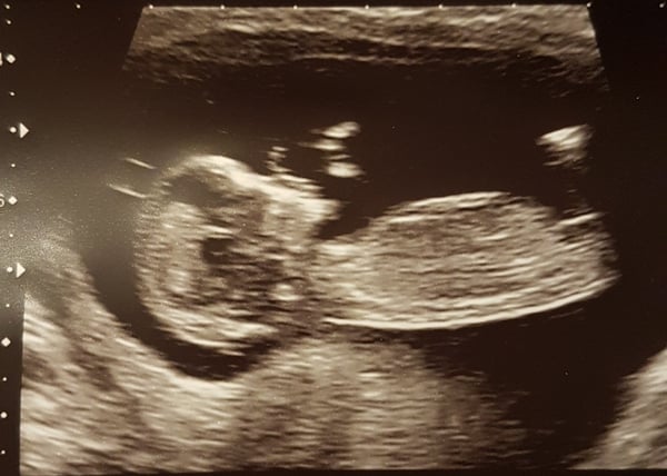 Anyone fancy a guess?!