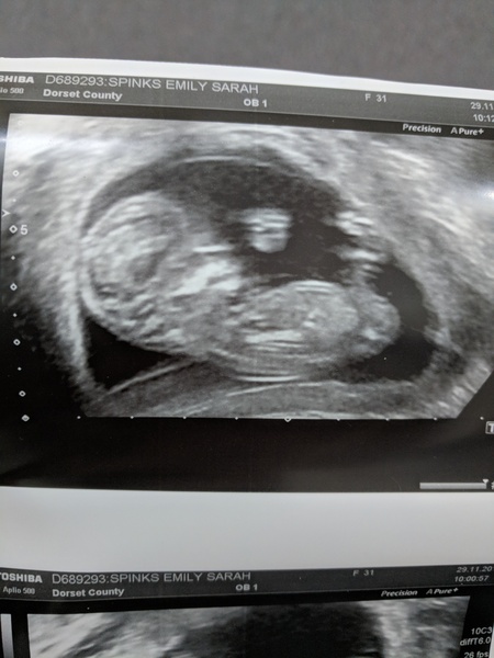 First Time Pregnancy: Summer Babies 2018