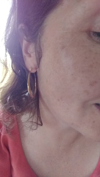 Has anyone got rid of or improved the appearance of age spots / pigmentation without lasers???