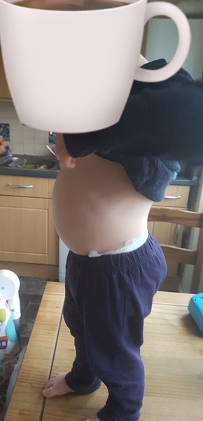 Should my 2yr old stomach look like this?