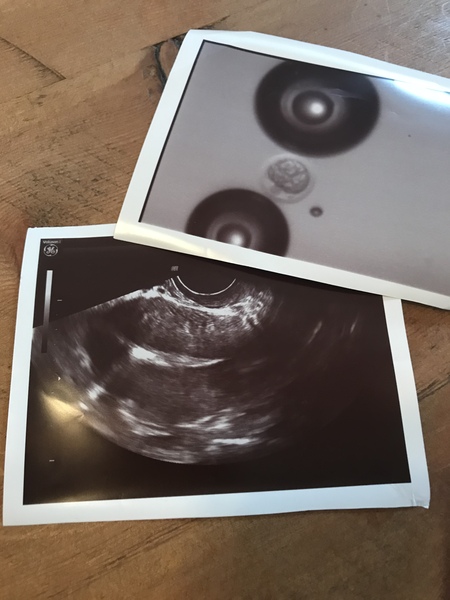 IVF SEP/OCT Part 2- Get your Stretchy Leggings here ladies!