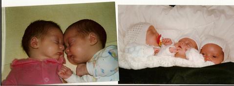 What to expect when bringing triplets home (born at 31 weeks)