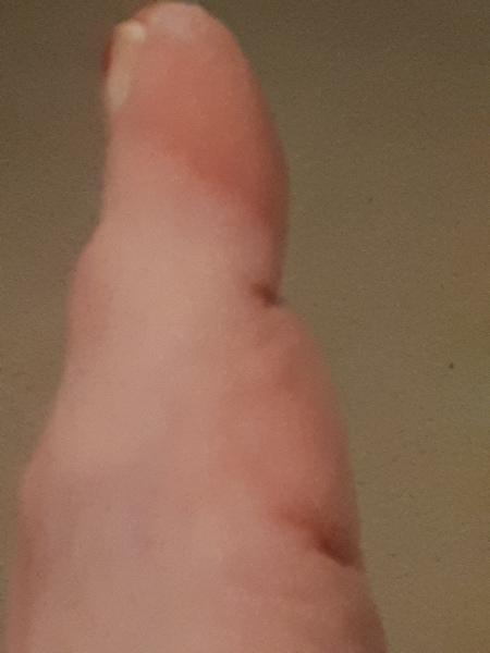 Any ideas about my toes? Pic attached