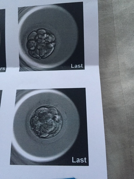 IVF SEP/OCT Part 2- Get your Stretchy Leggings here ladies!