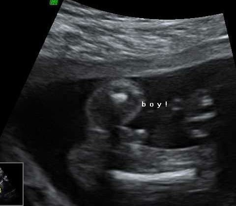 Thread no.2 for babies due April 2018