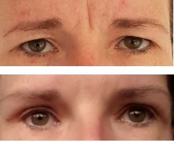 cosmetic surgery