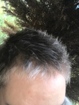 Head shave to go grey