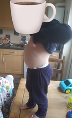 Should my 2yr old stomach look like this?