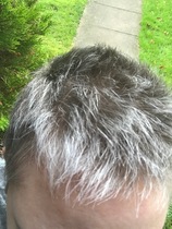 Head shave to go grey