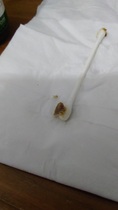 ****Klaxon**** DH's Earwax.  With Pics!