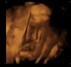 Thread no.2 for babies due April 2018