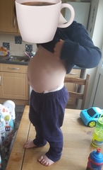 Should my 2yr old stomach look like this?