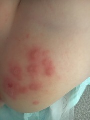To question the doctors diagnosis?