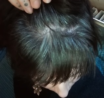 Head shave to go grey