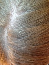 Head shave to go grey