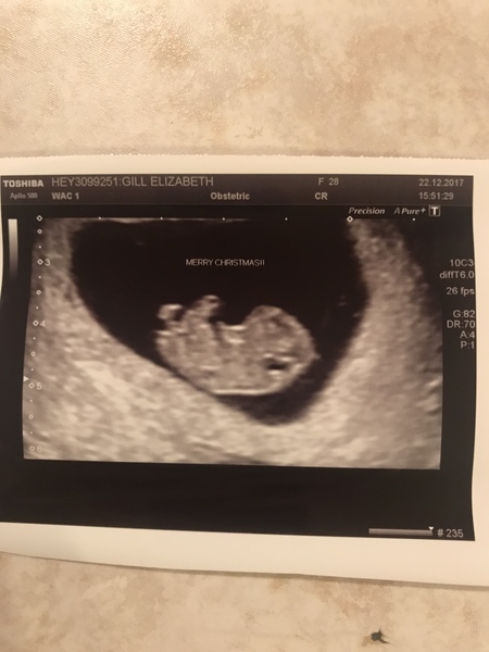 First Time Pregnancy: Summer Babies 2018