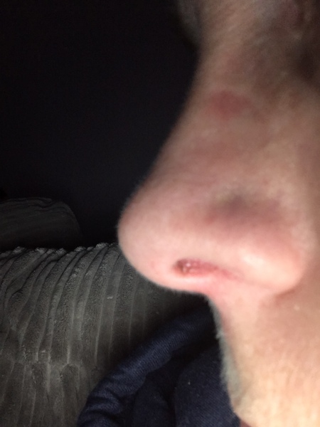 Nose AIBU