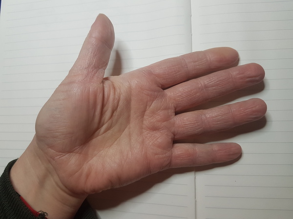 My hands look old. Help!