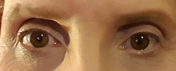 Odd eye shape?