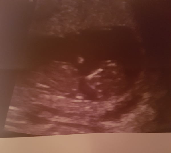 Baby nub theory