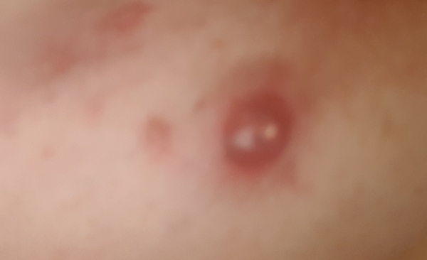 klaxon... filled back up and ready to erupt