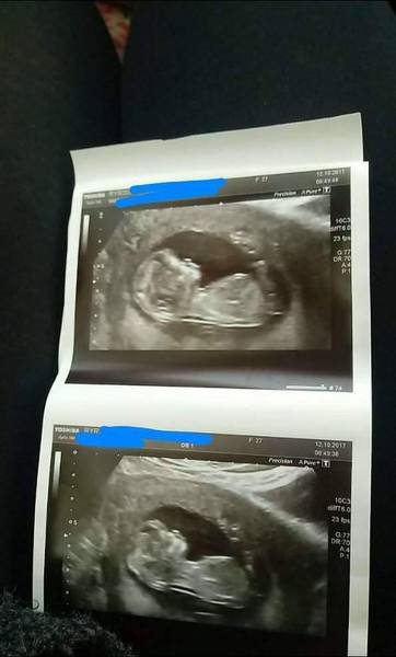 Nub gender guesses? 💗💙?