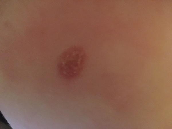 I can’t get into the doctors for two weeks. What does this look like?