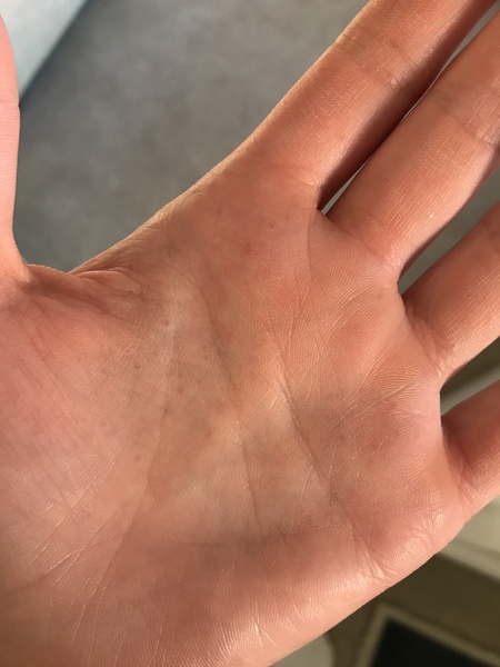 What are these??? ***Pic attached***