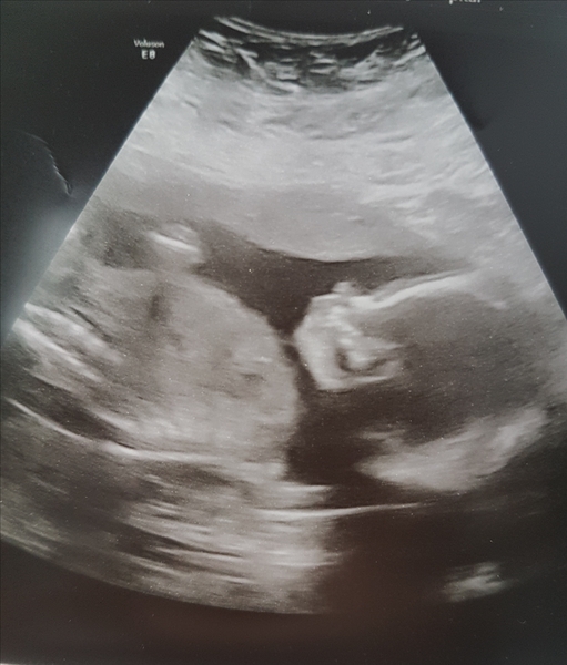 Due April 2018 thread #3