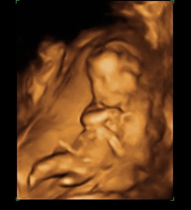 Babies due May 2018