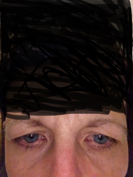 What can I do about my eyes