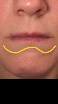 What is happening to my face?