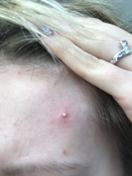 When can I squeeze this?