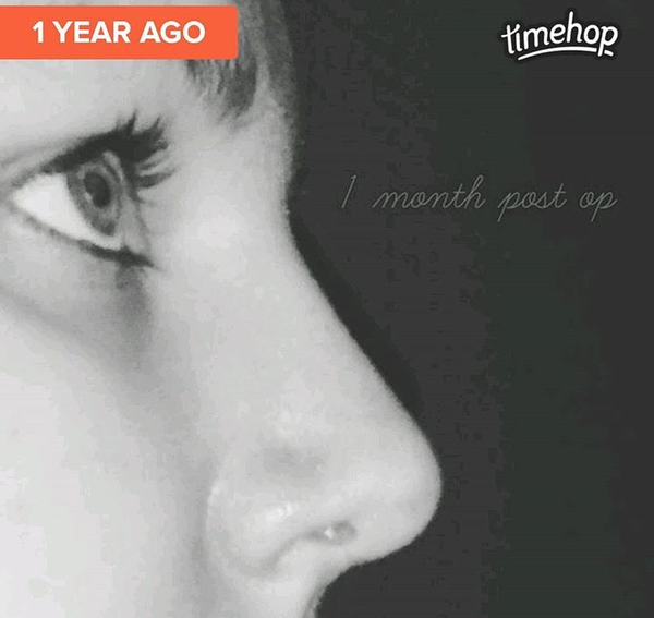 Nose AIBU