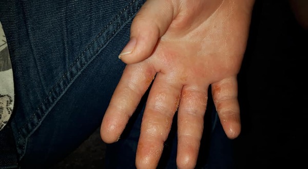 What do you think this is? *Gross picture, sorry*