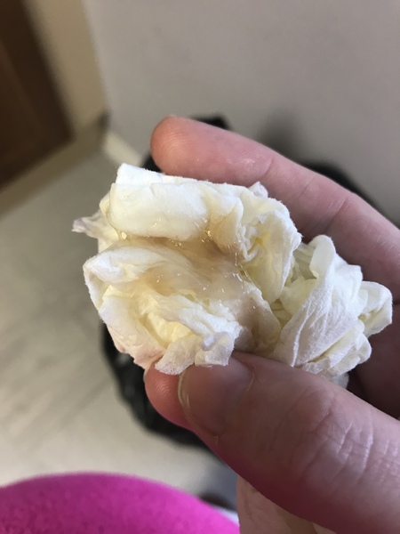 Is this my mucus plug ?