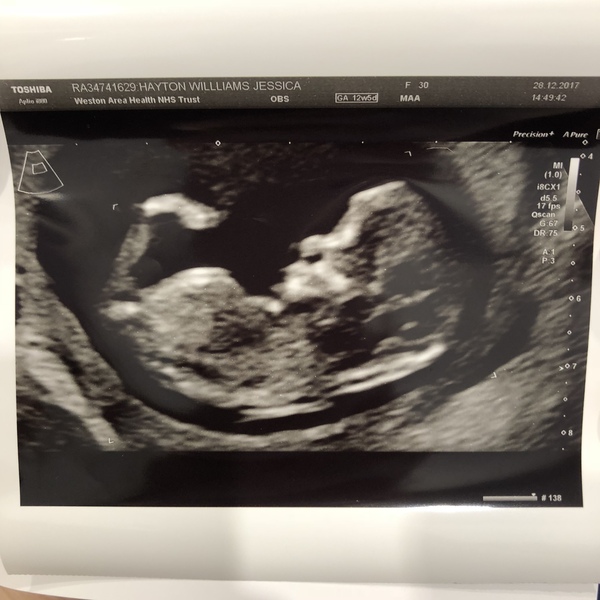 July 2018 babies - part 2 :)