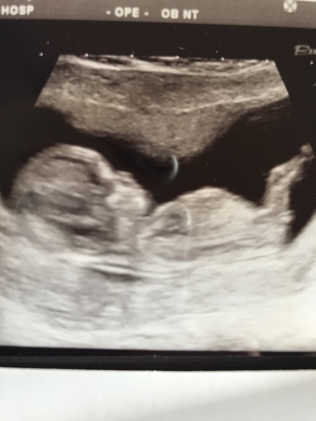 Babies due May 2018